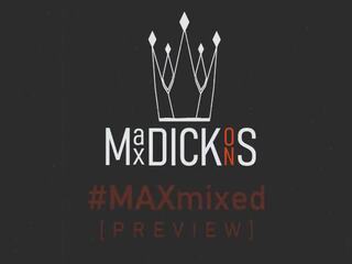 Max dickons - kuszące mieszany zestawienie, hd seks wideo b3